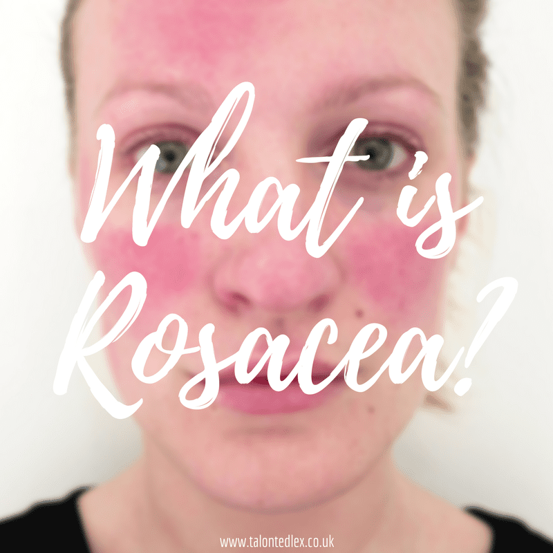 What is rosacea? Skincare and how to manage the condition...