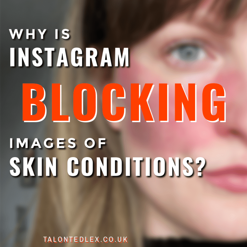 Why Is Instagram Hiding Images Of Skin Conditions Talonted Lex