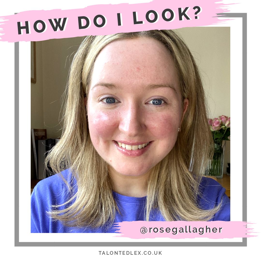 Read my interview with Rose (@rosegallagher): make up artist and rosacea sufferer. She shares her rosacea advice, make up tips, and advice on how to be positive even on bad days. #talontedlex #skinpositivity #rosaceatips #rosaceamakeup
