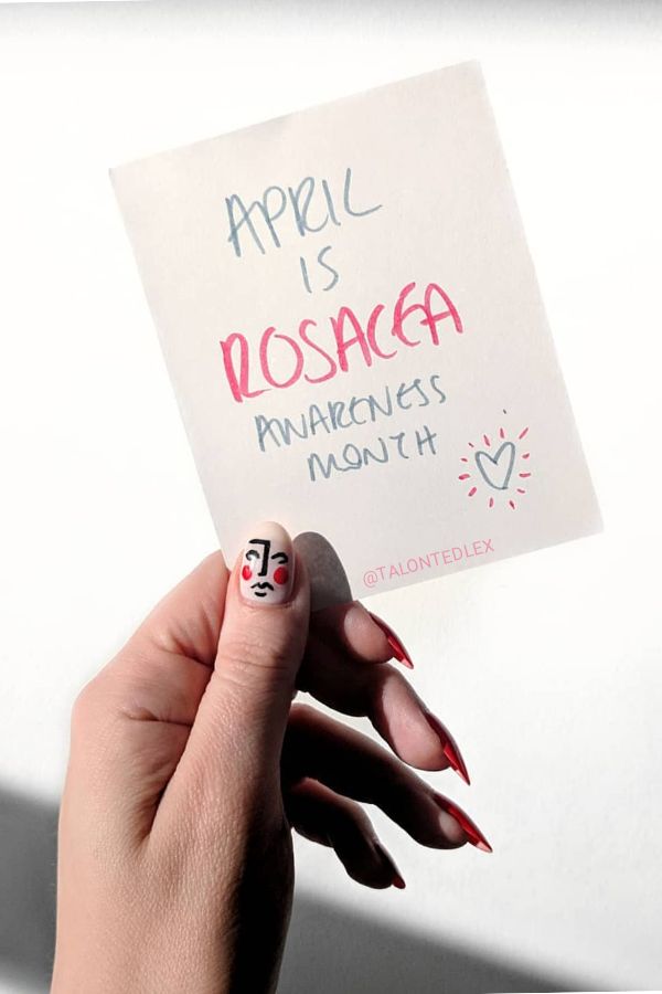 April is Rosacea Awareness Month so I wanted to celebrate with some cute nail art. What is rosacea? Rosacea tips and skincare advice. #talontedlex #rosaceaadvice #rosaceahelp
