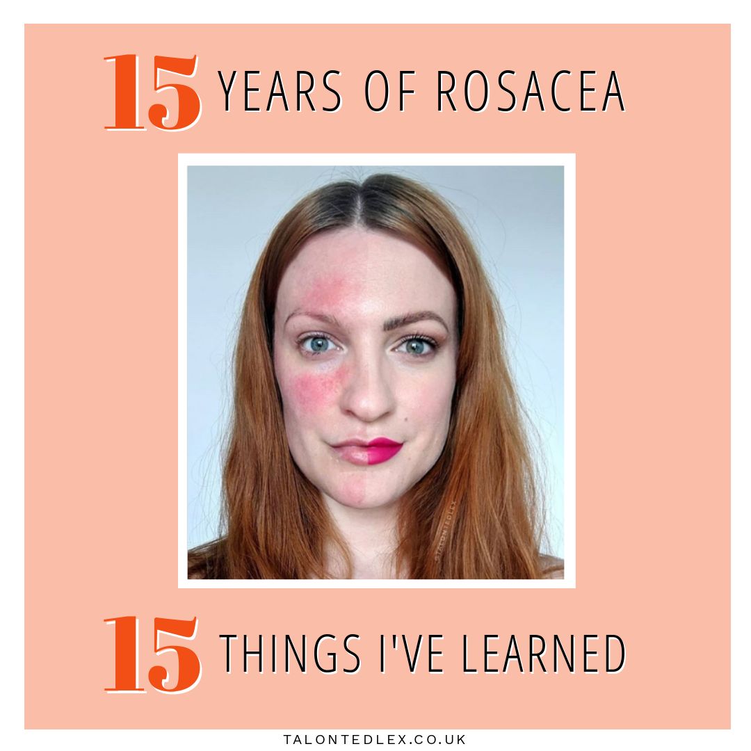 15-years-of-rosacea-what-i-ve-learned-talonted-lex